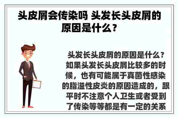 头皮屑会传染吗 头发长头皮屑的原因是什么？